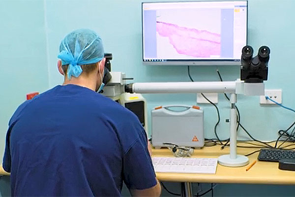 Mohs surgery